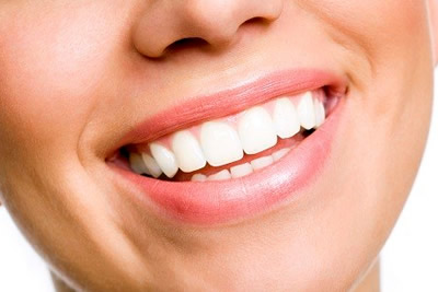 Teeth Whitening