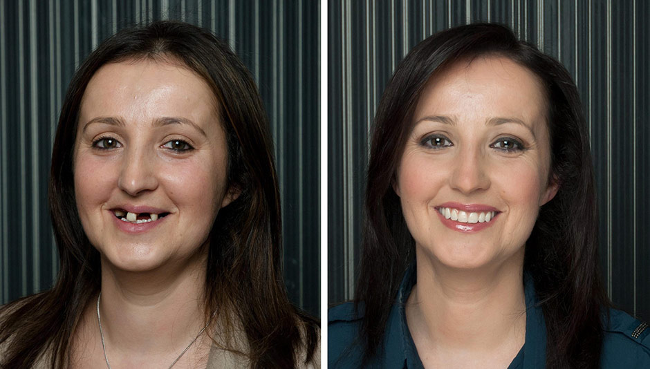 Dental work gallery image 1