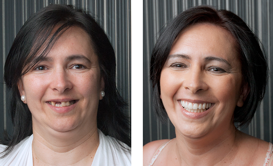Dental work gallery image 3